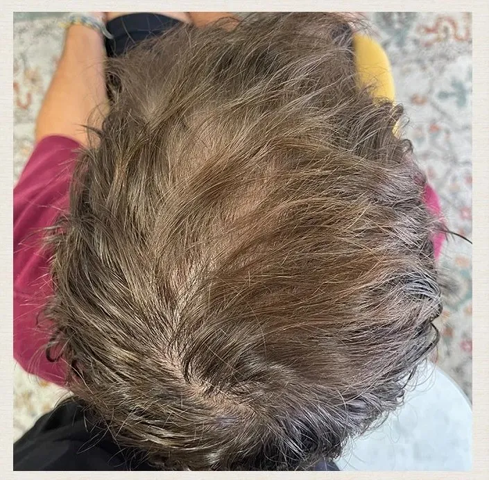 Before treatment