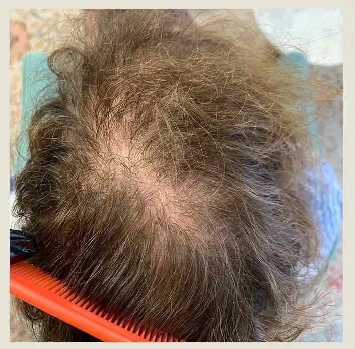 Before treatment