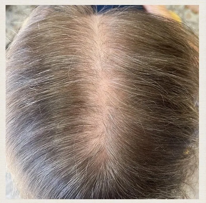 Before treatment