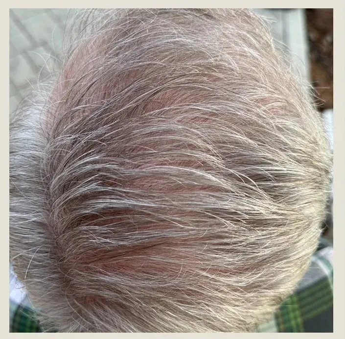 Before treatment