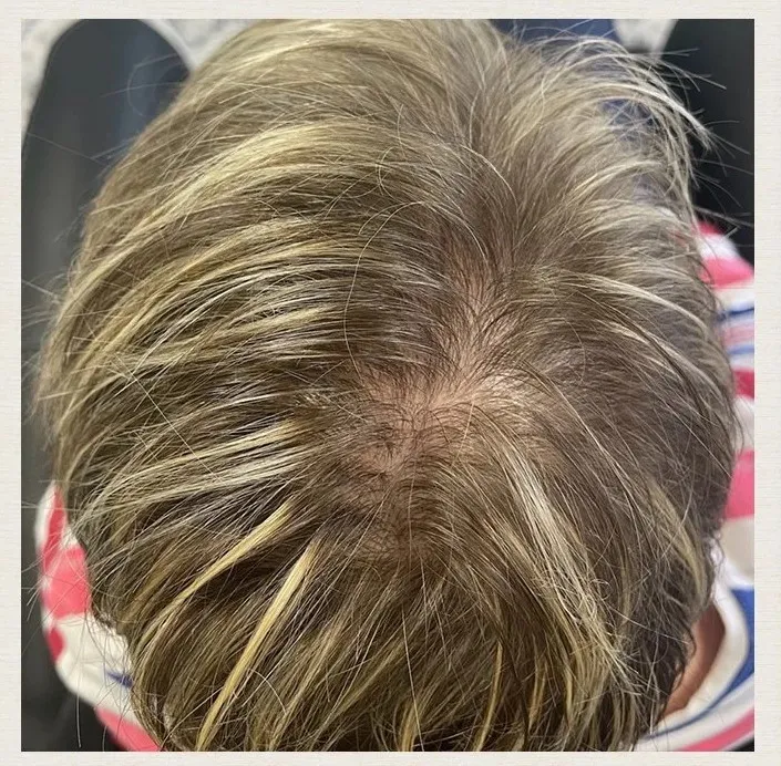 Before treatment