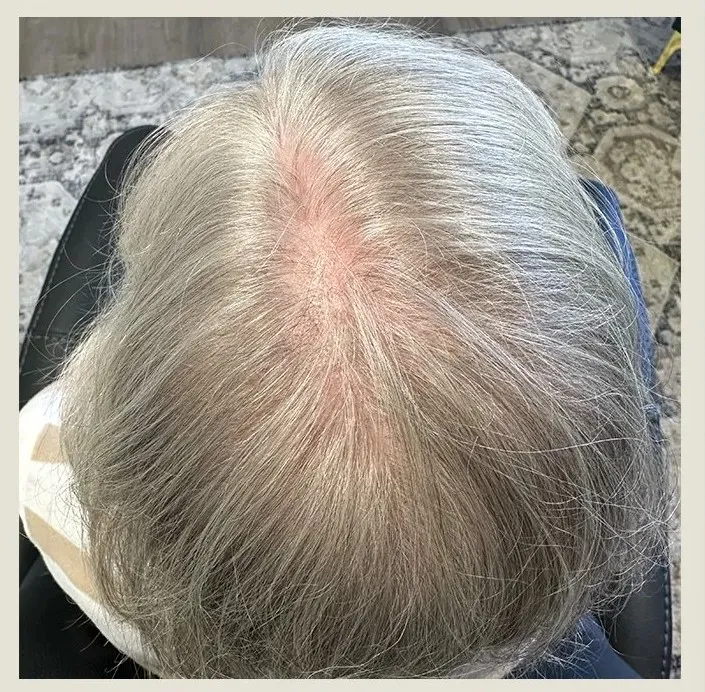Before treatment