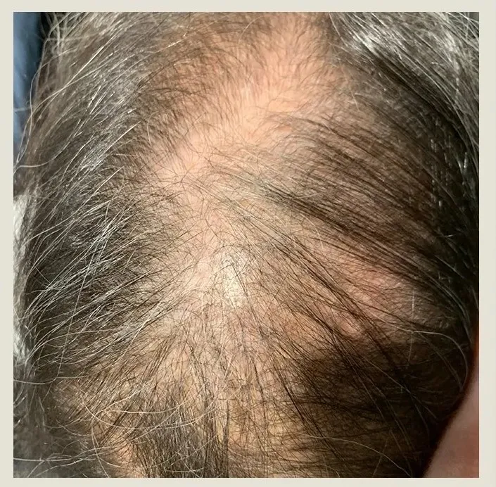 Before treatment