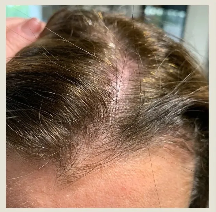 Before treatment
