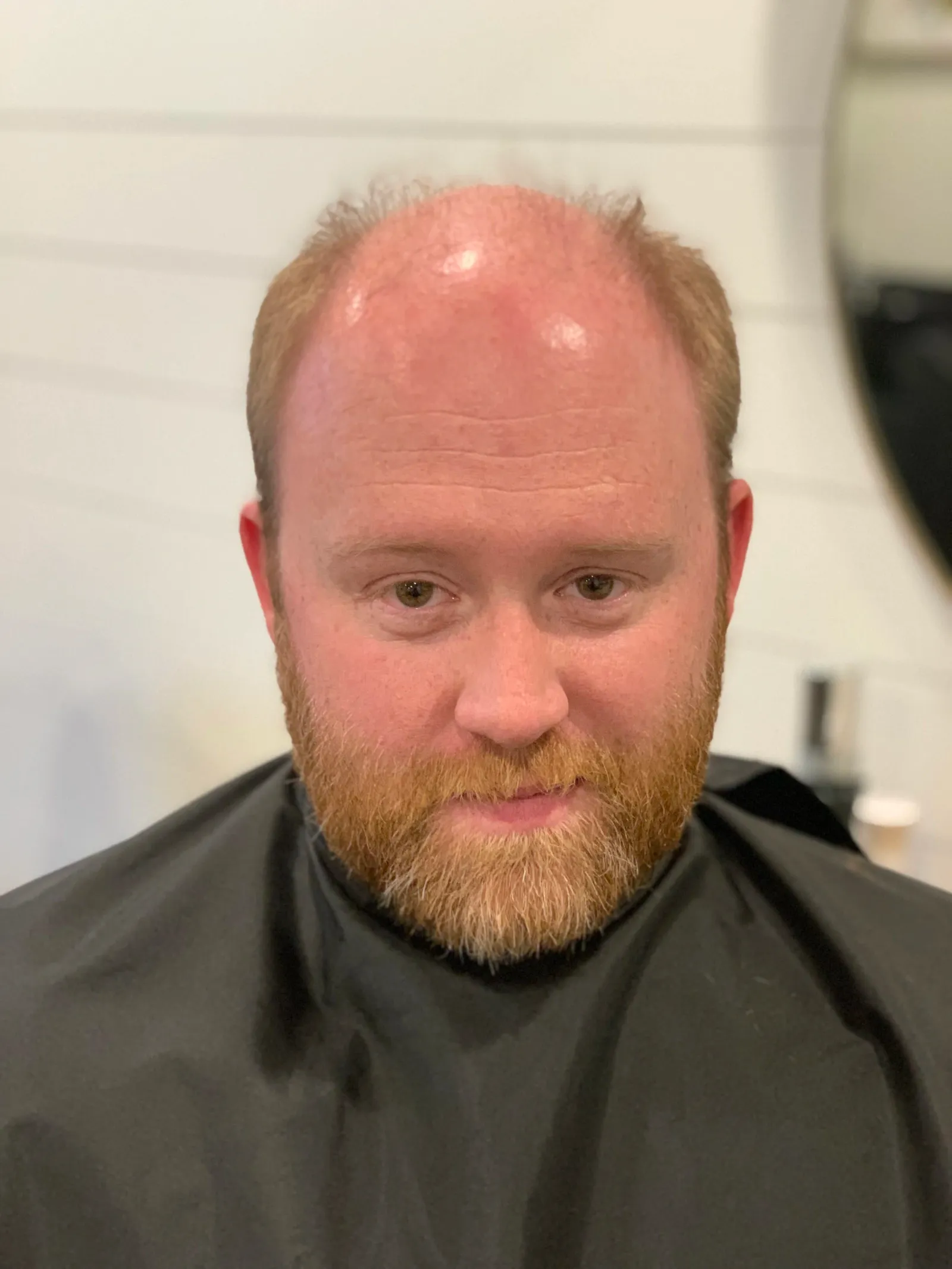 Before - Full coverage